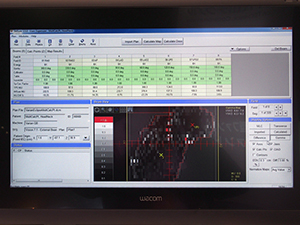 「IMSure QA」は“3-ソースモデル”により精度の高い計算が可能