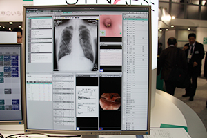 CITA Clinical Finderではさまざまな情報を自由にレイアウトできる“メディカル・ガジェット”機能を搭載