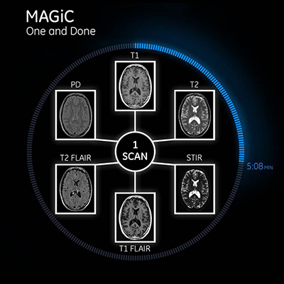 MRI診断を変える新たなイノベーションMAGiC 特設サイト