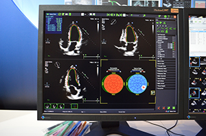 「トムテック 汎用画像解析システム（TomTec-Arena）」