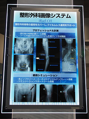 整形外科向けPACSの「iRad-OT」