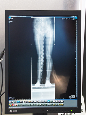 「iRad-OT」は，高度な計測ツールを搭載し，術前シミュレーションも可能