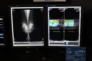 新製品のマンモグラフィ画像表示用21.3型5MPカラーディスプレイ「CCL550i2」（右）