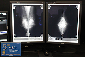サブピクセル独立ドライブテクノロジーにより15MP相当の画素数を実現した5MPモノクロディスプレイ「MS55i2」
