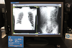 医用画像表示用30型6MPカラーディスプレイ「CCL650i2」