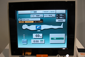 患者情報をモニタに呼び出すことで造影剤副作用などを確認できる“CE-Evidence-System”