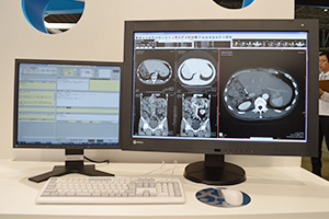 DICOM Viewer「EV Insite R」に新機能「スライディングモード」が搭載