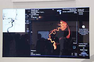 「Artis zee PURE」シリーズでは，“syngo Dyna 4D”など豊富なアプリケーションを搭載