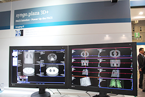 syngo.viaの機能を融合した3D PACS「syngo.plaza 3D+」
