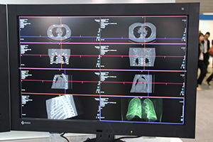 “ALPHA Technology”の自動位置合わせ機能で読影業務を支援