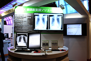 胸部X線骨組織透過テクノロジーコーナー
