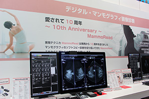 デジタル・マンモグラフィ画像診断コーナー