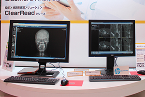 IMS Web Viewer System（左）とBlackford Analysis（右）