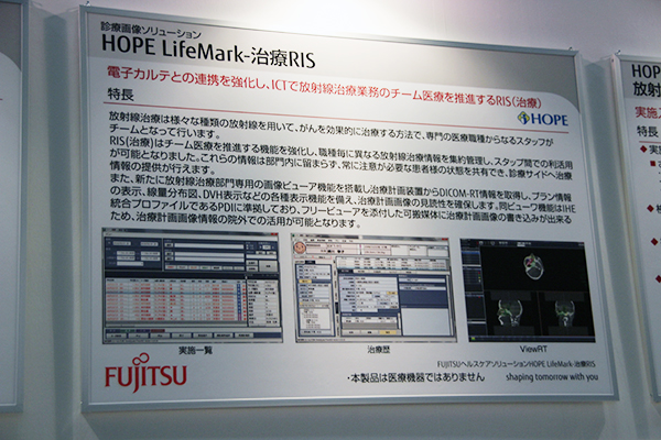 放射線治療業務のチーム医療を支援する「HOPE LifeMark-治療RIS」