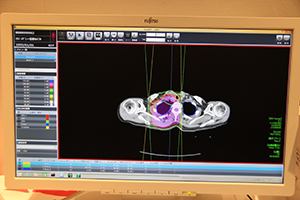 放射線治療計画装置の画像情報を表示するRTビューワを搭載