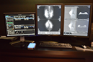 乳腺画像診断ワークステーション「mammodite」