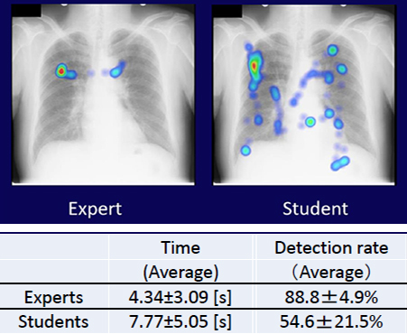 資料ご提供 「X線胸部画像の注視点解析」 群馬県立県民健康科学大学・大学院　教授　小倉 敏裕 様