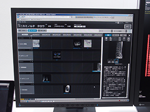 「NEOVISTA I-PACS CX」の検査項目のマトリックス画面