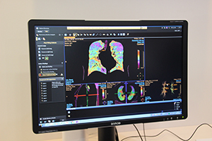 ネットワーク型ワークステーション「IntelliSpace Portal V8」