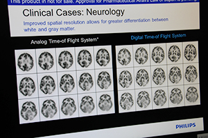 従来のPET/CT（左）とデジタルPET/CT（薬機法未承認）（右）の画像