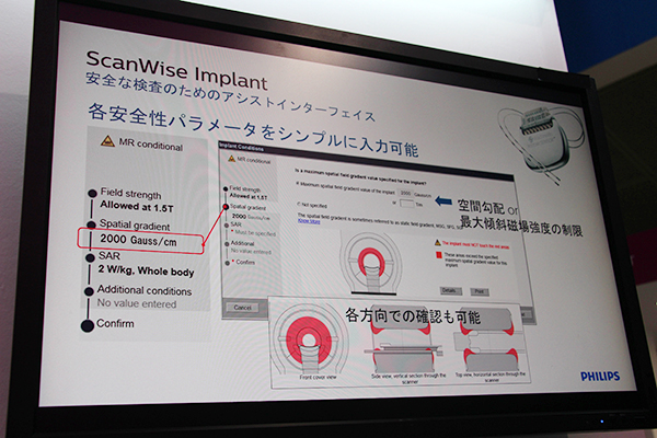 “ScanWise Implant”ではインプラントデバイスを近づけてはいけない場所もわかりやすく表示される。