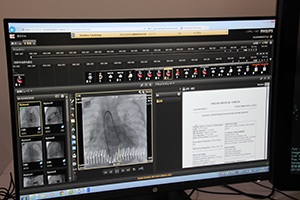 患者のデータをタイムラインで把握できる心臓血管領域の部門PACS「IntelliSpace CardioVascular（ISCV）」