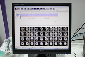 アレイ社Array AOCのビューワ画面