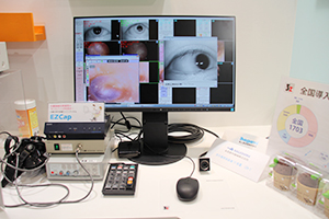 CT検査が増加傾向にある耳鼻咽喉科に最適化された画像ファイリングシステムEZCap 2.5