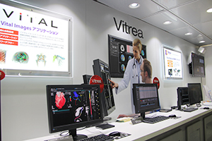 医用画像処理ワークステーション「Vitrea」の豊富なアプリケーションを紹介