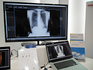 ブースではPACSブリッジ機能による外部データの参照のデモを実施