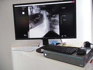 MPEG4/H.264準拠の動画像の取り込みと参照を可能にする「MP DICOM」