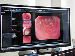 ONIS 3のビューワではMPEG4の表示にも対応