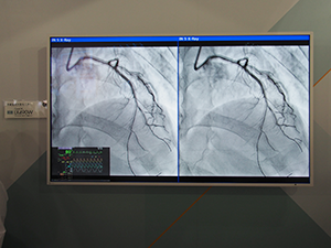 ハイブリッド手術室向け映像支援ソリューションコーナーに展示された49インチ画像表示モニター「CuratOR LX490W」
