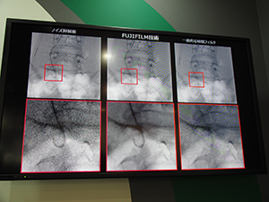 デジタルX線の画像処理技術を生かして開発した医療用X線動画技術を紹介