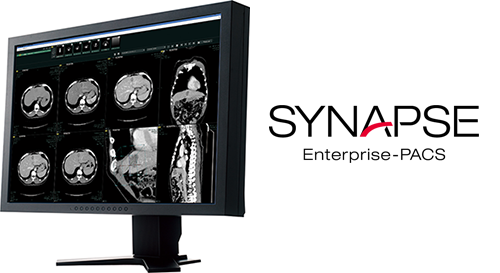 医療画像情報システム（PACS）　SYNAPSE 5