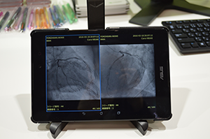 Android対応のDICOMビューワ（プロトタイプ）