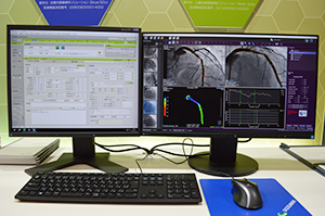 Cardiology総合管理ソリューション「Goodnet」