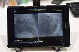 Android OSにも対応するDICOM画像ビューワ（プロトタイプ）