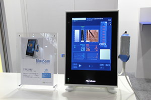 重量が10kgにまで軽量化され，検査室への設置が容易な「FibroScan 530 Compact」