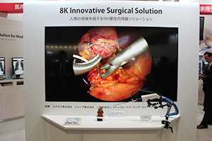 カイロス，シャープ，MIC，JVCが共同開発した，8K解像度対応の内視鏡システム（薬機法未承認）