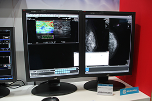 マンモグラフィ診断適合の認証を取得した「CCL550i2」