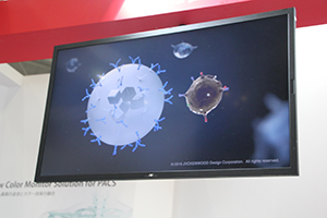 マイクロビーズによりエクソームを吸着する