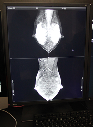 mammoditeのビューワ