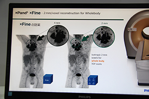 「Ingenuity TF PET/CT」では“xFine”により高分解能の画像を取得可能