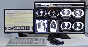 PACS「EV Insite net」がより使いやすく