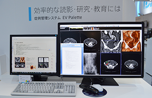 症例管理システム「EV Palette」