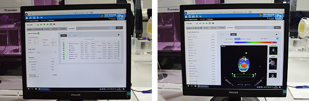 ビームの微細なズレなどを把握できる「PerFRACTION」の3D線量解析の結果（左）と画像（右）