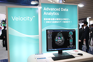 放射線治療計画支援システム「Velocity」