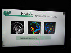 三次元医用画像認識技術である“RealiZe”に基づくZiostation2の新機能をアピール