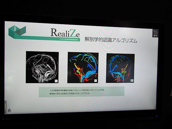 三次元医用画像認識技術“RealiZe”
